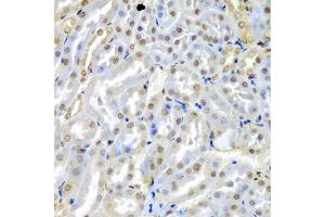 Immunohistochemistry of paraffin-embedded mouse kidney using TUSC2 antibody at dilution of 1:200 (40x lens).