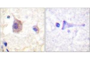 Immunohistochemistry analysis of paraffin-embedded human brain, using PKD1/PKC mu (Phospho-Tyr463) Antibody.