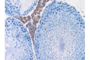 Used in DAB staining on fromalin fixed paraffin- embedded liver tissue