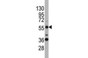 Western blot analysis of SOX9 antibody and K562 lysate. (SOX9 anticorps  (AA 41-70))