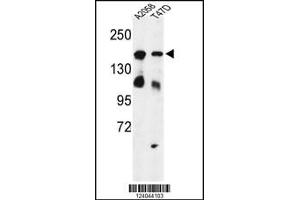 Western blot analysis of HDLBP Antibody in A2058, T47D cell line lysates (35ug/lane) (HDLBP anticorps  (AA 764-791))
