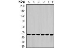 Western blot analysis of Cytokeratin 18 expression in HepG2 (A), Hela (B), mouse liver (C), mouse skeletal muscle (D), C2C12 (E), rat heart (F) whole cell lysates. (Cytokeratin 18 anticorps)
