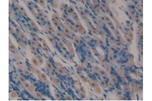Detection of LTF in Mouse Stomach Tissue using Polyclonal Antibody to Lactoferrin (LTF) (Lactoferrin anticorps  (AA 63-193))