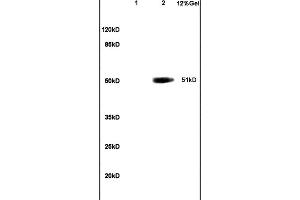 Lane 1: mouse embryo lysates Lane 2: human colon carcinoma lysates probed with Anti OCT2 Polyclonal Antibody, Unconjugated (ABIN737316) at 1:200 in 4C.