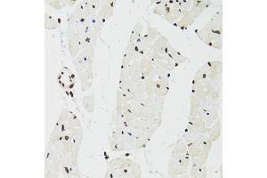 Immunohistochemistry of paraffin-embedded mouse heart using SFPQ antibody (ABIN5970351) at dilution of 1/100 (40x lens). (SFPQ anticorps)