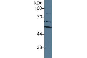 Detection of ACHE in Human HepG2 cell lysate using Polyclonal Antibody to Acetylcholinesterase (ACHE) (Acetylcholinesterase anticorps  (AA 157-332))