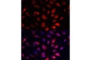 Immunofluorescence analysis of NIH/3T3 cells using ENO3 antibody (ABIN7266960) at dilution of 1:100.