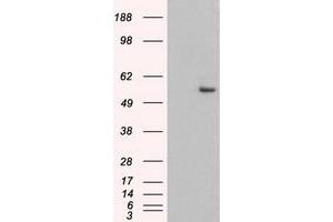 Image no. 3 for anti-Keratin 8 (KRT8) (AA 91-381) antibody (ABIN1491712) (KRT8 anticorps  (AA 91-381))
