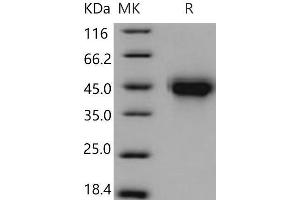 Western Blotting (WB) image for Tumor Necrosis Factor Receptor Superfamily, Member 1B (TNFRSF1B) (Active) protein (His tag) (ABIN7320395)
