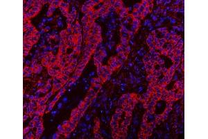 IF analysis of CLASP1 using anti-CLASP1 antibody (ABIN7599144). (CLASP1 anticorps  (AA 1-243))