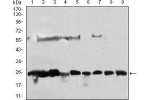 Western blot analysis using CSNK2B mouse mAb against Hela (1), Jurkat (2), K562 (3), HepG2 (4), C6 (5), SK-N-SH (6), NTERA-2 (7), MCF-7 (8), NIH/3T3 (9) cell lysate.