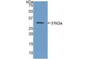 Detection of Recombinant COL4a1, Human using Polyclonal Antibody to Collagen Type IV Alpha 1 (COL4a1) (COL4A1 anticorps  (AA 1444-1669))