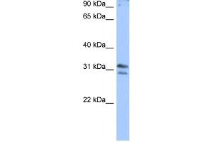 WB Suggested Anti-RG9MTD3 Antibody Titration:  0. (RG9MTD3 anticorps  (N-Term))
