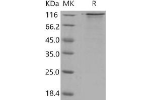 Western Blotting (WB) image for Low Density Lipoprotein Receptor (LDLR) (Active) protein (His tag) (ABIN7320327)
