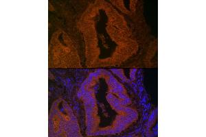anti-Myosin VB (MYO5B) (AA 1440-1690) antibody