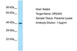 Image no. 1 for anti-Olfactory Receptor 52A5 (OR52A5) (C-Term) antibody (ABIN6749903) (OR52A5 anticorps  (C-Term))