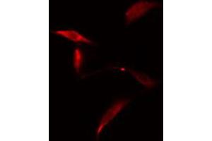 ABIN6274829 staining A549 cells by IF/ICC. (AKR1E2 anticorps  (Internal Region))