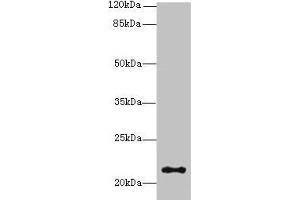 Western blot All lanes: JAGN1 antibody at 3 μg/mL + HL60 whole cell lysate Secondary Goat polyclonal to rabbit IgG at 1/10000 dilution Predicted band size: 22 kDa Observed band size: 22 kDa (JAGN1 anticorps  (AA 1-39))