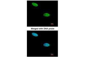 ICC/IF Image Immunofluorescence analysis of paraformaldehyde-fixed HeLa, using DUSP26, antibody at 1:200 dilution. (DUSP26 anticorps  (Center))