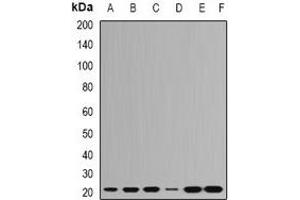 Western blot analysis of RPL9 expression in Hela (A), HepG2 (B), SHSY5Y (C), Jurkat (D), mouse brain (E), mouse spleen (F) whole cell lysates. (RPL9 anticorps)