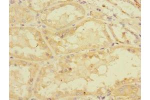 Immunohistochemistry of paraffin-embedded human kidney tissue using ABIN7160526 at dilution of 1:100 (PDE4DIP anticorps  (AA 1-310))