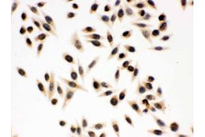 IHC analysis of p95 NBS1 using anti-p95 NBS1 antibody .