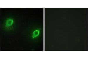 Immunofluorescence analysis of HeLa cells, using AKAP5 Antibody. (AKAP5 anticorps  (AA 1-50))