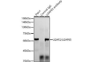 Immunoprecipitation analysis of 300 μg extracts of HeLa cells using 3 μg U2/U2 antibody (ABIN1682786, ABIN3019042, ABIN3019043 and ABIN7101704).