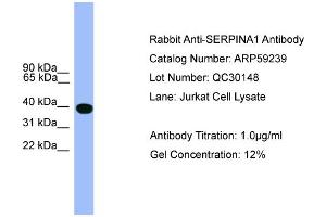 WB Suggested Anti-SERPINA1  Antibody Titration: 0. (SERPINA1 anticorps  (C-Term))