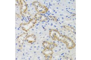 Immunohistochemistry of paraffin-embedded rat kidney using MTERFD3 antibody at dilution of 1:100 (x40 lens).