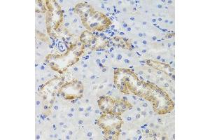 Immunohistochemistry of paraffin-embedded rat kidney using MTERFD3 antibody at dilution of 1:100 (x40 lens). (MTERFD3 anticorps)