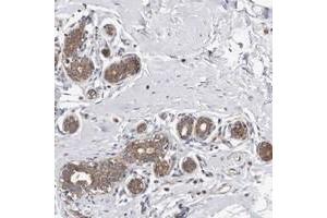 Immunohistochemical staining of human breast with FAM54B polyclonal antibody  shows moderate cytoplasmic positivity in glandular cells at 1:50-1:200 dilution. (MTFR1L anticorps)