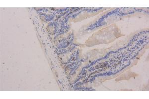Detection of PECAM1 in Mouse Intestine Tissue using Polyclonal Antibody to Platelet/Endothelial Cell Adhesion Molecule (PECAM1)