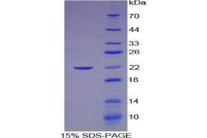 SDS-PAGE of Protein Standard from the Kit  (Highly purified E. (LAMC2 Kit ELISA)