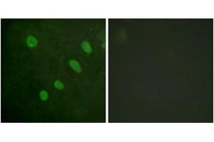 Immunofluorescence analysis of HeLa cells, using ATF2 (Phospho-Ser480) Antibody. (ATF2 anticorps  (pSer480))