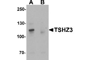 Western blot analysis of TSHZ3 in mouse brain tissue lysate with TSHZ3 antibody at 1 µg/mL in (A) the absence and (B) the presence of blocking peptide. (TSHZ3 anticorps  (N-Term))