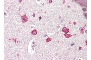 Human Brain, Cortex (formalin-fixed, paraffin-embedded) stained with TSLPat 2. (Thymic Stromal Lymphopoietin anticorps)