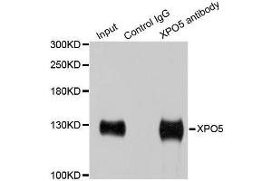 Immunoprecipitation analysis of 200ug extracts of HeLa cells using 1ug XPO5 antibody.