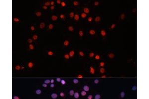 Immunofluorescence analysis of C6 cells using SUMO1 Polyclonal Antibody at dilution of 1:100. (SUMO1 anticorps)