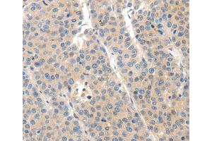 Immunohistochemistry (IHC) image for anti-Solute Carrier Family 20 (Phosphate Transporter), Member 1 (SLC20A1) antibody (ABIN2426893) (SLC20A1 anticorps)