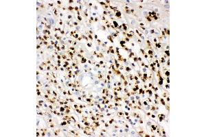 Anti-Myeloperoxidase Picoband antibody,  IHC(P): Human Appendicitis Tissue