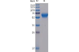 Human BTLA Protein, mFc-His Tag on SDS-PAGE under reducing condition.