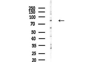 anti-EPS8-Like 2 (EPS8L2) (N-Term) antibody