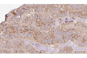 anti-TBC1 Domain Family, Member 4 (TBC1D4) (pSer588) antibody