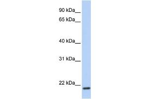 WB Suggested Anti-TMEM35 Antibody Titration:  0. (TMEM35 anticorps  (C-Term))