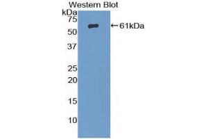 Western Blotting (WB) image for anti-beta-Adrenergic Receptor Kinase (AA 398-640) antibody (ABIN1857927) (beta-Adrenergic Receptor Kinase (AA 398-640) anticorps)