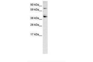 Image no. 2 for anti-Sp7 Transcription Factor (SP7) (C-Term) antibody (ABIN6735947) (SP7 anticorps  (C-Term))