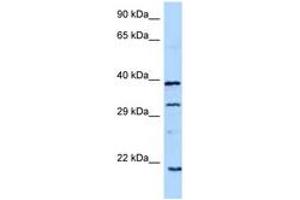 Image no. 1 for anti-Growth Hormone 1 (GH1) (C-Term) antibody (ABIN6748200) (Growth Hormone 1 anticorps  (C-Term))