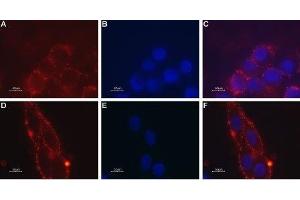 Expression of Melanin-concentrating hormone receptor 1 in mouse brain glioma - Cell surface detection of MCHR1 in mouse brain glioma (C6) intact living cells.