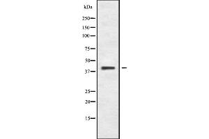 Western blot analysis of CCR8 using COLO205 whole cell lysates (CCR8 anticorps  (C-Term))